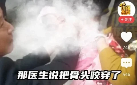 恶犬当街咬穿女孩腿骨，伤势严重！狗主人跪地道歉，行为惹争议